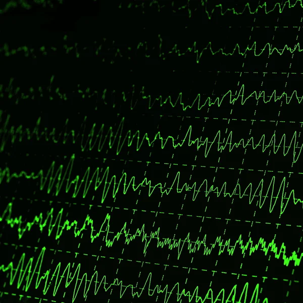 Grafico verde onda cerebrale EEG — Foto Stock