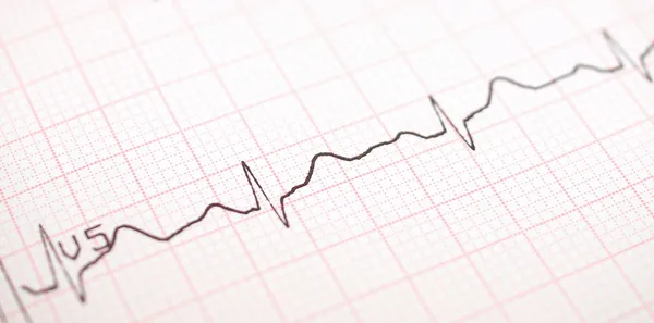 EKG grafiği, Elektrokardiyogram ekg — Stok fotoğraf
