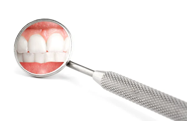 Зеркало дантиста — стоковое фото