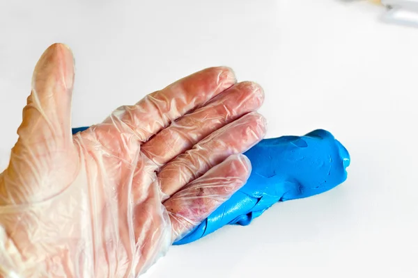 Fisioterapia della mano per recuperare un cercatore rotto — Foto Stock