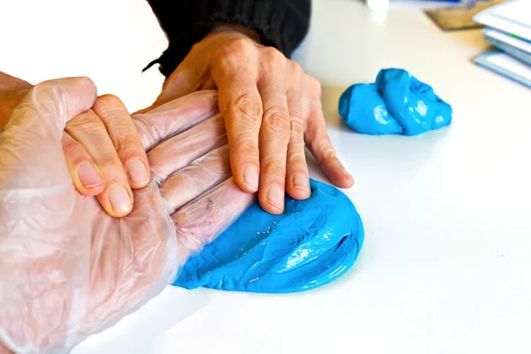 Физиотерапия рук для восстановления сломанного поисковика — стоковое фото