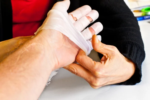 Hand fysiotherapie om een gebroken vinder te herstellen — Stockfoto