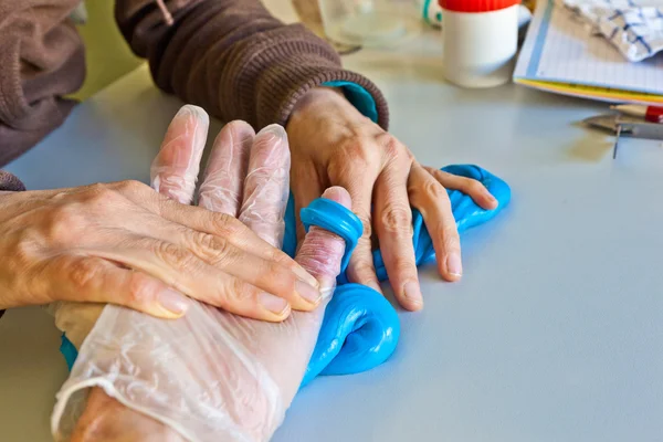 Физиотерапия рук, чтобы восстановить палец — стоковое фото
