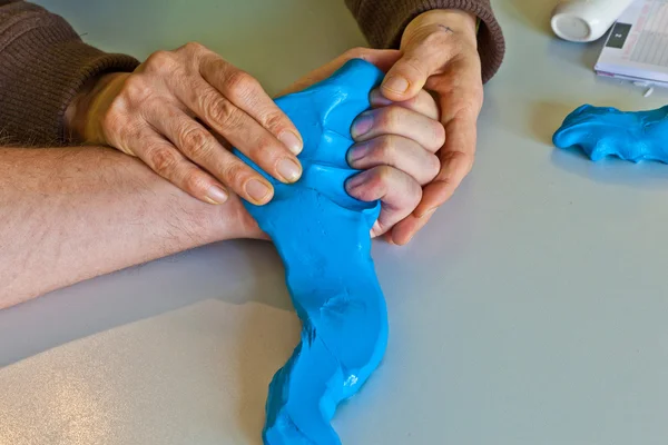 Fisioterapia de manos para recuperar un dedo — Foto de Stock