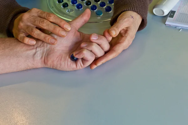 Fizioterápia-hoz visszaszerez egy ujj kéz — Stock Fotó