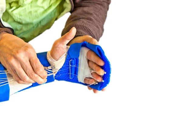 Hand physiotherapy to recover a finger — Stock Photo, Image