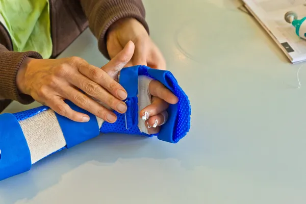Физиотерапия рук, чтобы восстановить палец — стоковое фото