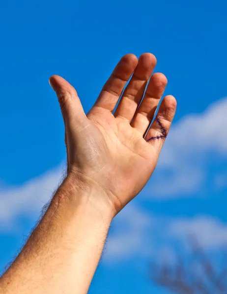 Little finger gestikt na een operatie — Stockfoto