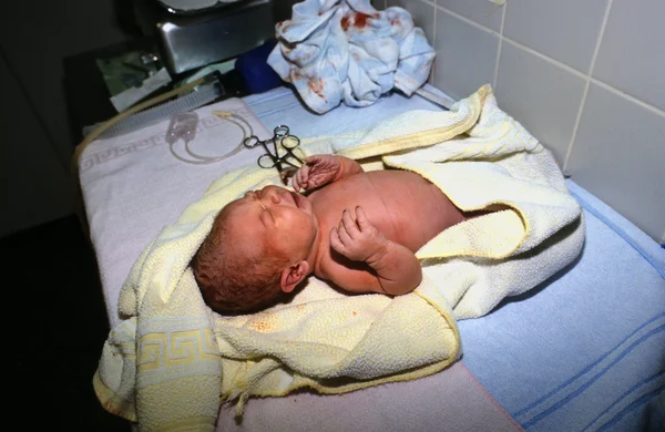 stock image Baby after birth in hospital