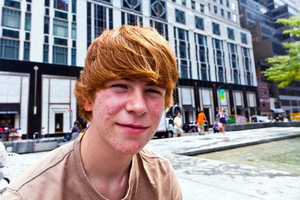 Ευτυχισμένο αγόρι στην εφηβεία με μερικά τουρσιά στο πρόσωπο — Φωτογραφία Αρχείου