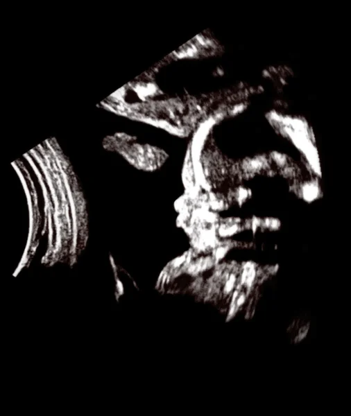 Ultra-som bebê — Fotografia de Stock