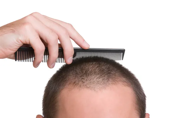 Recrutar o cabelo — Fotografia de Stock