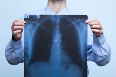 Chest x-ray clipart