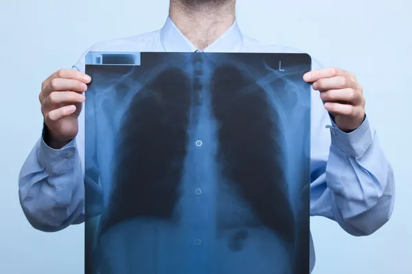 Bröstkorgsröntgen — Stockfoto