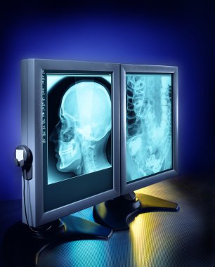 X-rays on computer screen clipart