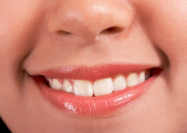 Feliz sonrisa y dientes blancos —  Fotos de Stock