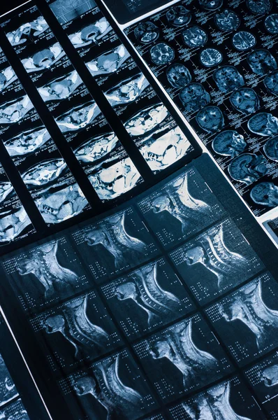 Birkaç ct bilgisayar tomografi taraması görüntüleri boyun ve beyin — Stok fotoğraf