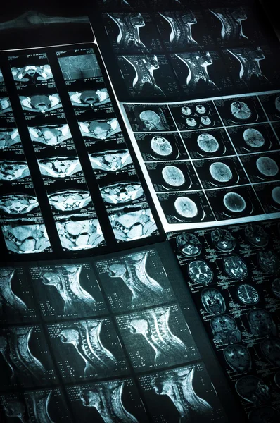 CT számítógépes tomográfia scan képek — Stock Fotó