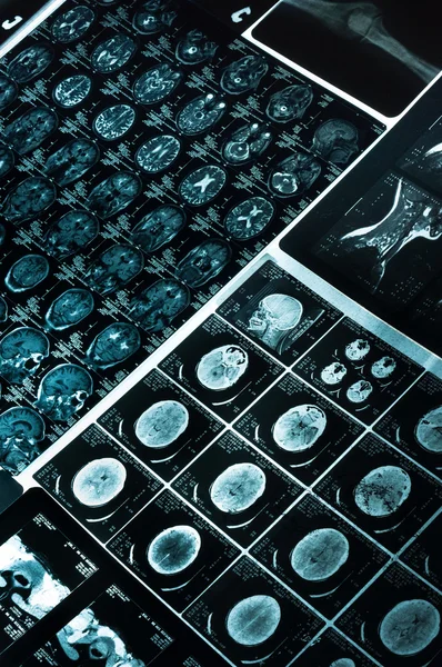 CT tomografii komputer skanowanie obrazów — Zdjęcie stockowe