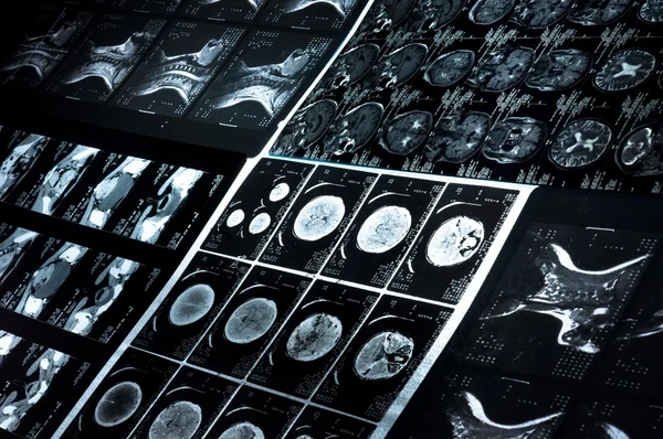Several CT computer tomography scan images of neck and brain — Stock Photo, Image