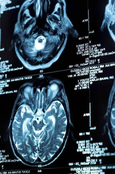 인간의 뇌는 타일의 ct 검사 — 스톡 사진