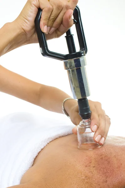Vacuum massage treatment — Stock Photo, Image