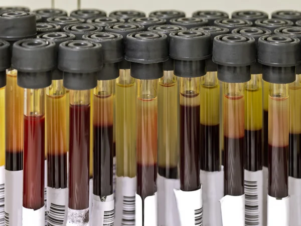 Tubos para análises ao sangue — Fotografia de Stock