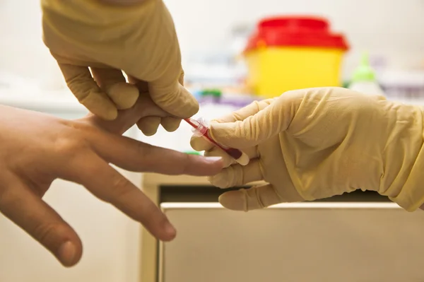 Анализ крови с пальца — стоковое фото