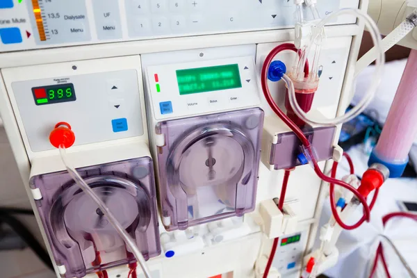 Arlificial kidney (dialysis) device — Stock Photo, Image