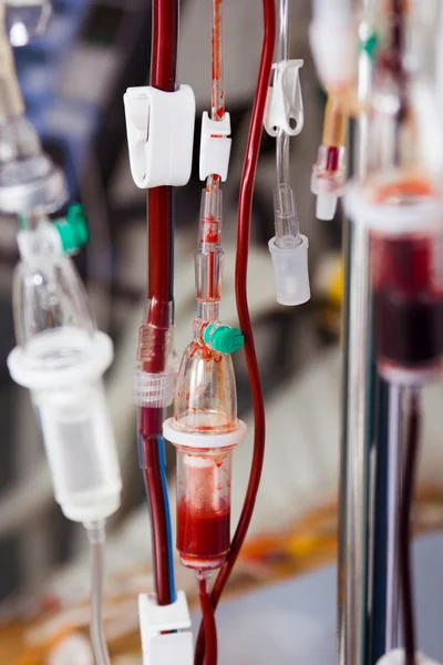 Blood transfusion in hospital — Stock Photo, Image