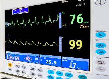 ICU cardiac monitor clipart