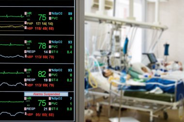 Patients monitoring in ICU clipart