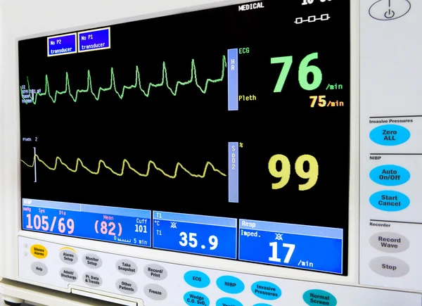 ICU monitora serca — Zdjęcie stockowe