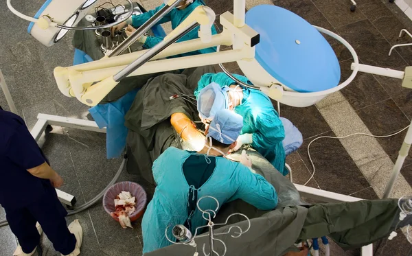 Squadra chirurghi in sala operatoria — Foto Stock