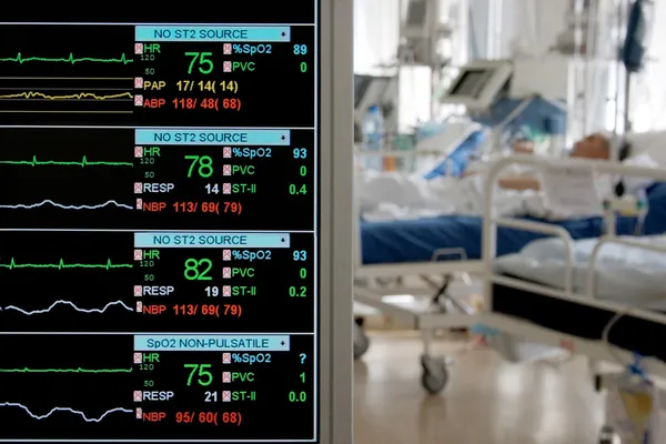 Övervakning på intensivvårdsavdelning — Stockfoto