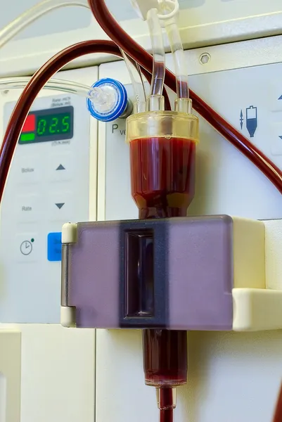 Dialyse medische apparaat — Stockfoto