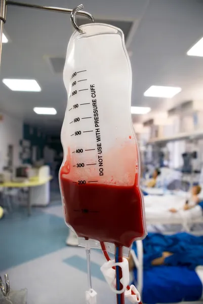 Trasfusione di sangue — Foto Stock