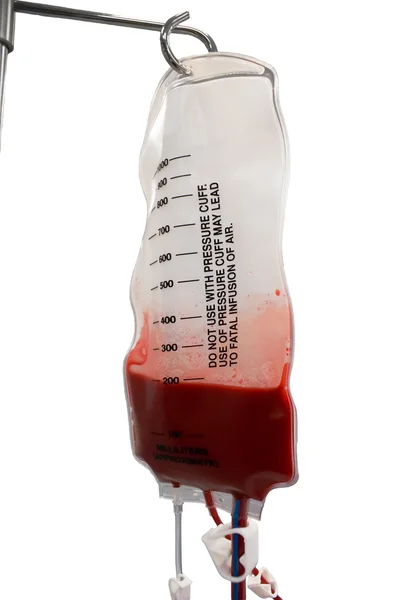 Bluttransfusion — Stockfoto