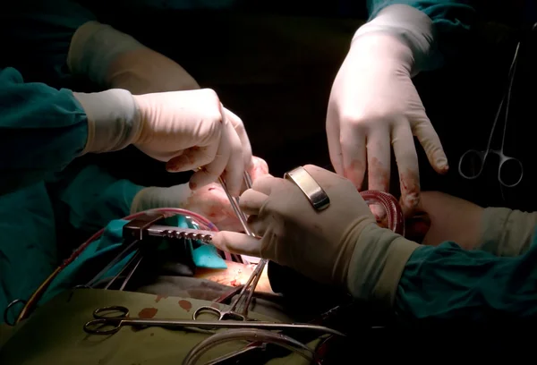 Mani di chirurghi — Foto Stock