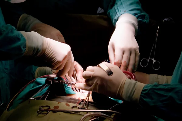 Mani di chirurghi — Foto Stock