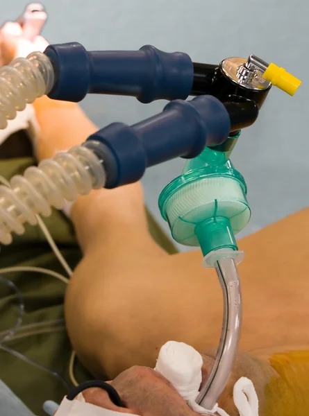 Ventilazione artificiale dei polmoni in sala operatoria — Foto Stock