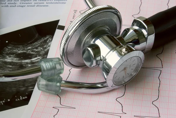 Стетоскоп с кардиограммой — стоковое фото