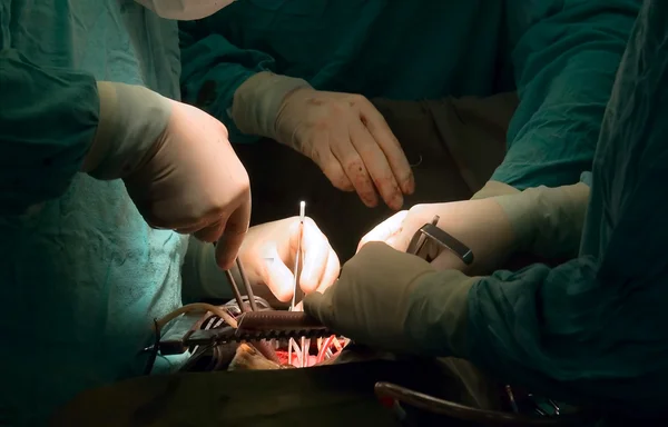 Prothetische hart ventiel implantatie — Stockfoto
