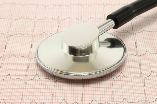 Fonendoscopio su un cardiogramma — Foto Stock
