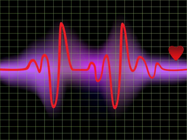 Heartbeat monitor — Stock Vector