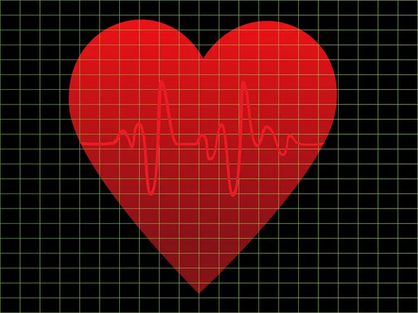 EKG or heart monitor — Stock Vector