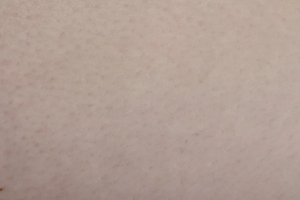 White skin texture — Stock Photo, Image
