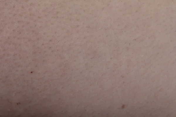 Textur der menschlichen Haut weiß — Stockfoto