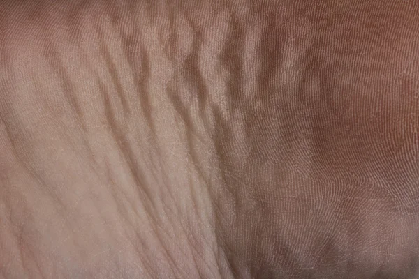 stock image Texture of human skin-fold