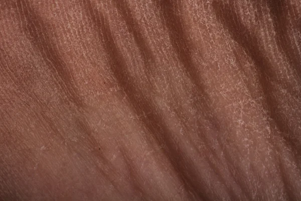 stock image Texture of human skin-fold